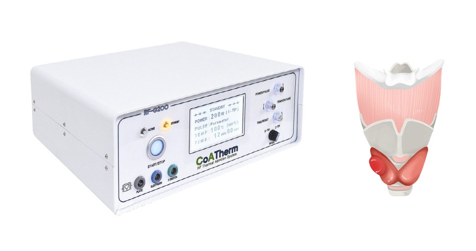 갑상선 고주파 치료